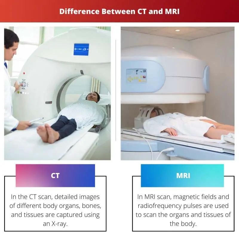 Difference Between CT and MRI