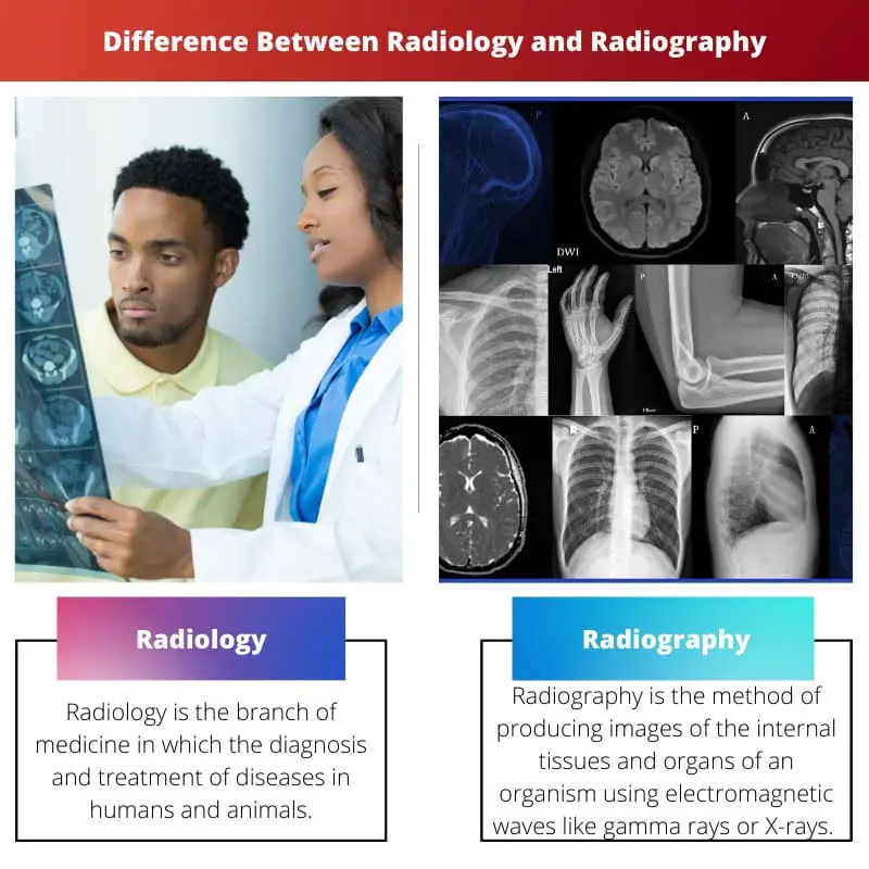 Difference Between Radiology and Radiography