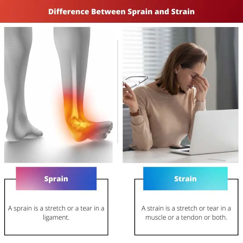 Difference Between Sprain and Strain