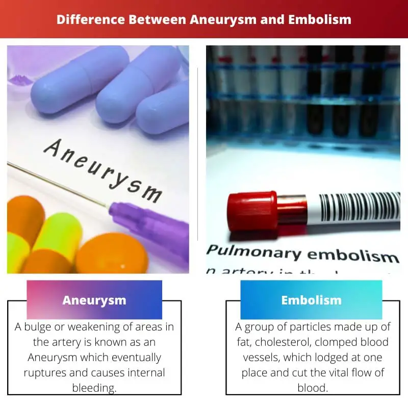 Difference Between Aneurysm and Embolism