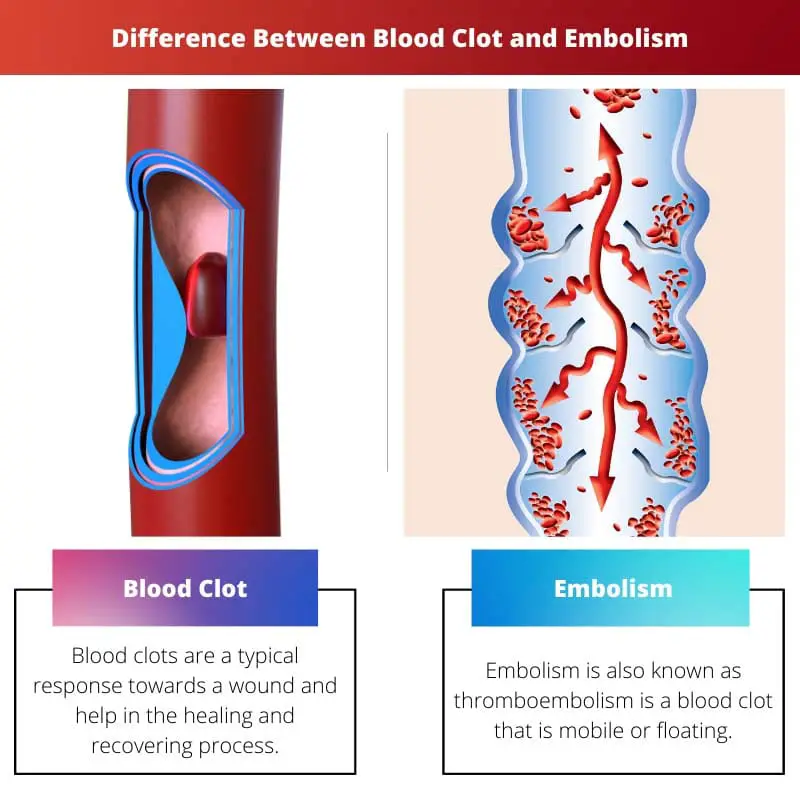 Difference Between Blood Clot and Embolism