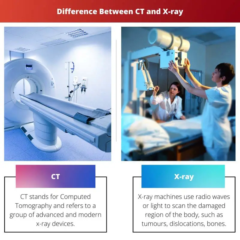 Difference Between CT and X ray