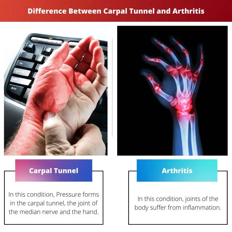 Difference Between Carpal Tunnel and Arthritis