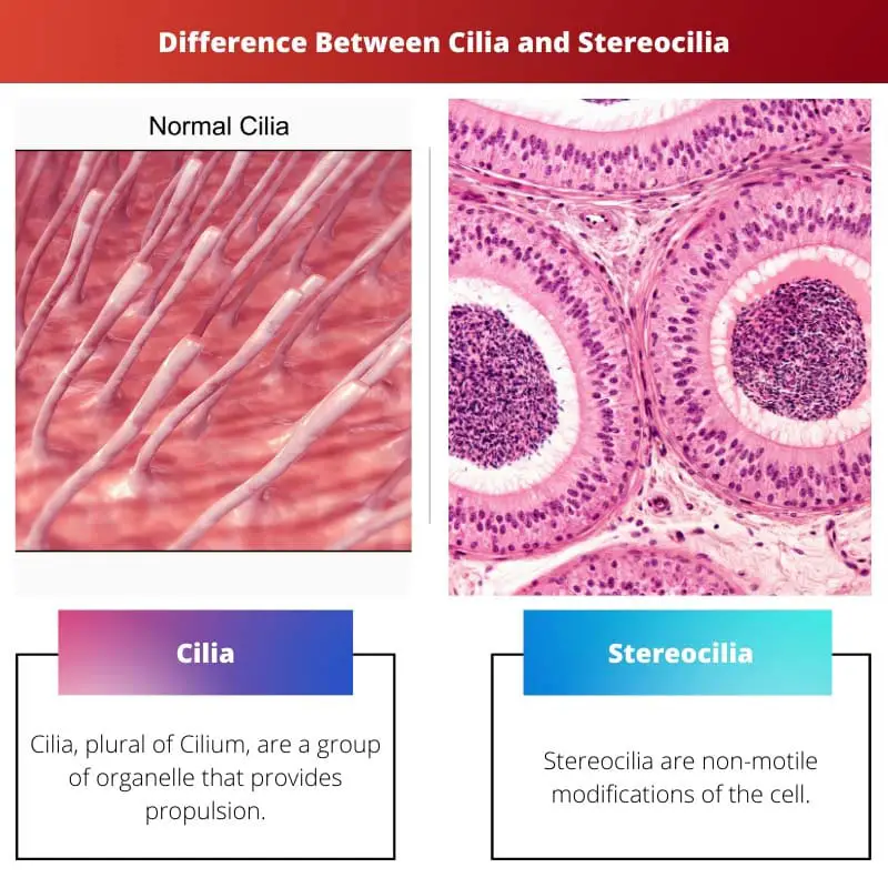 Difference Between Cilia and Stereocilia