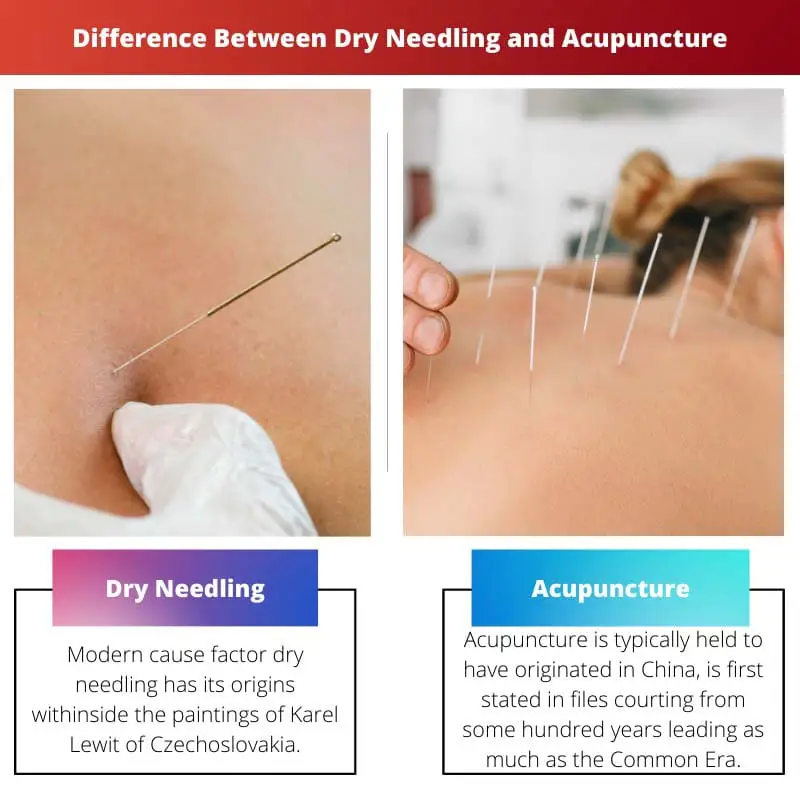 Difference Between Dry Needling and Acupuncture