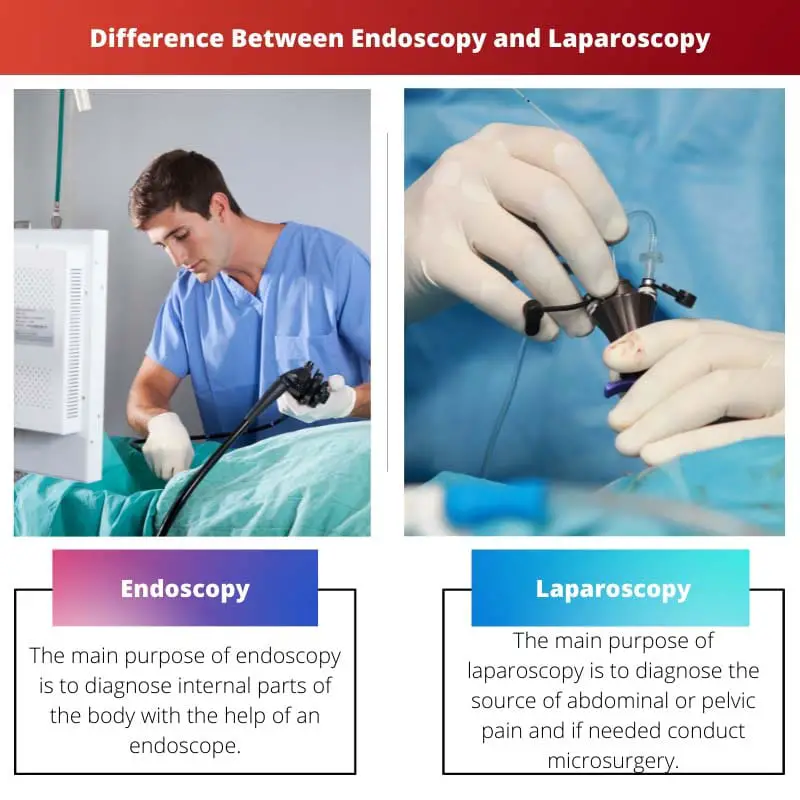 Difference Between Endoscopy and Laparoscopy