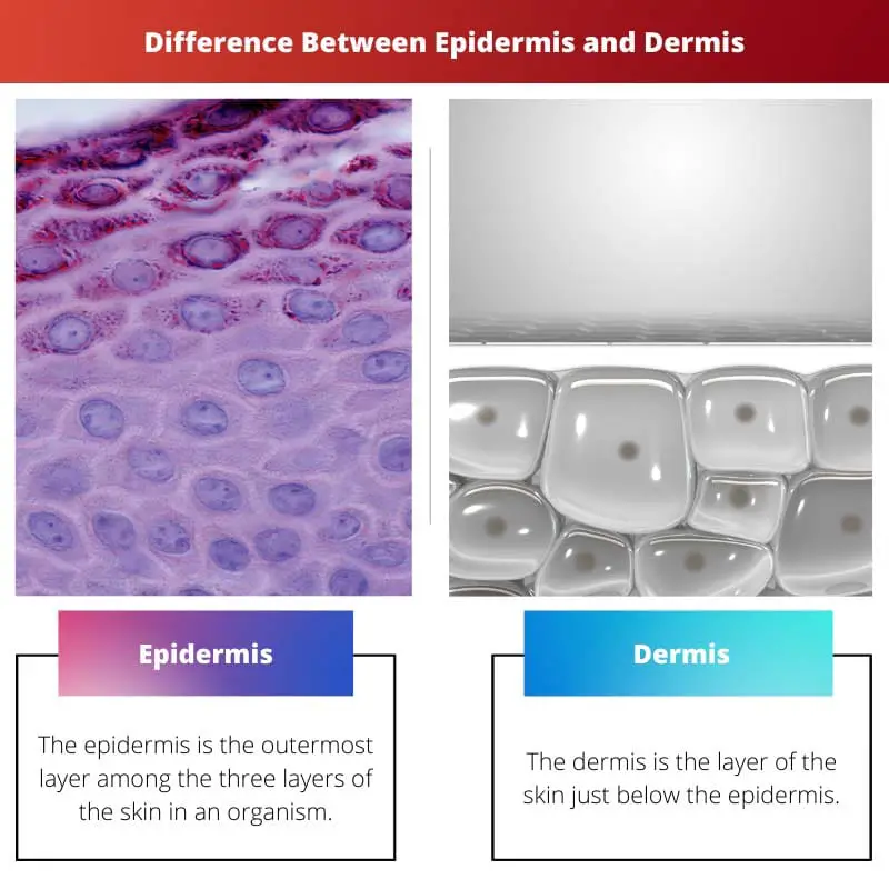 Difference Between Epidermis and Dermis
