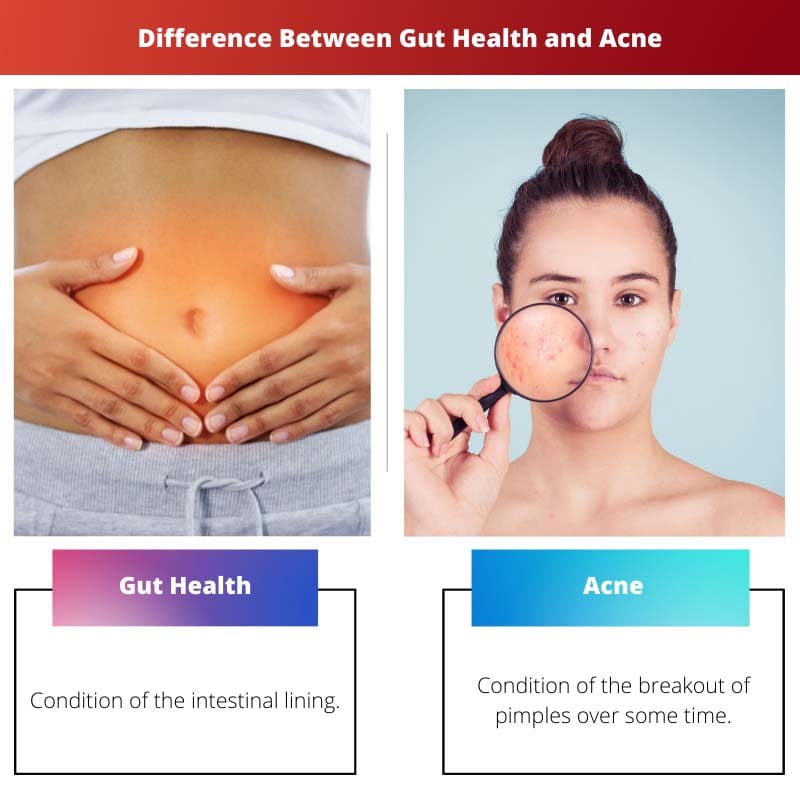 Difference Between Gut Health and Acne