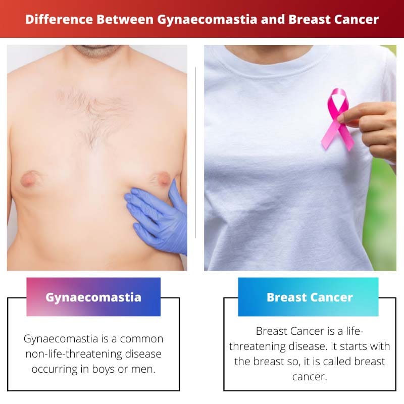 Difference Between Gynaecomastia and Breast Cancer