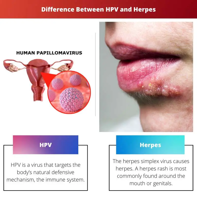 Difference Between HPV and Herpes
