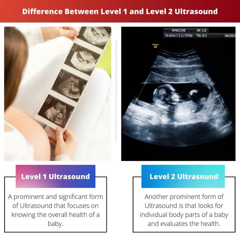 Difference Between Level 1 and Level 2 Ultrasound