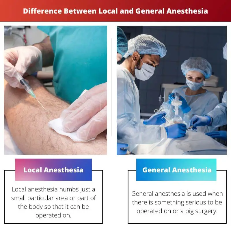Difference Between Local and General Anesthesia