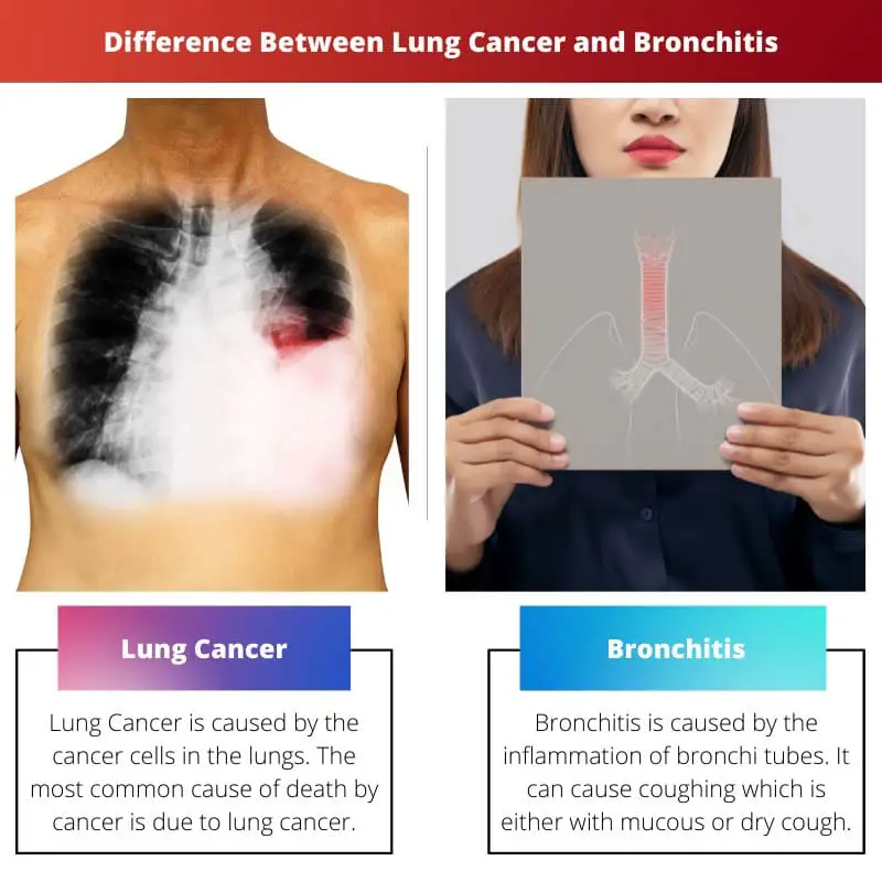 Difference Between Lung Cancer and Bronchitis