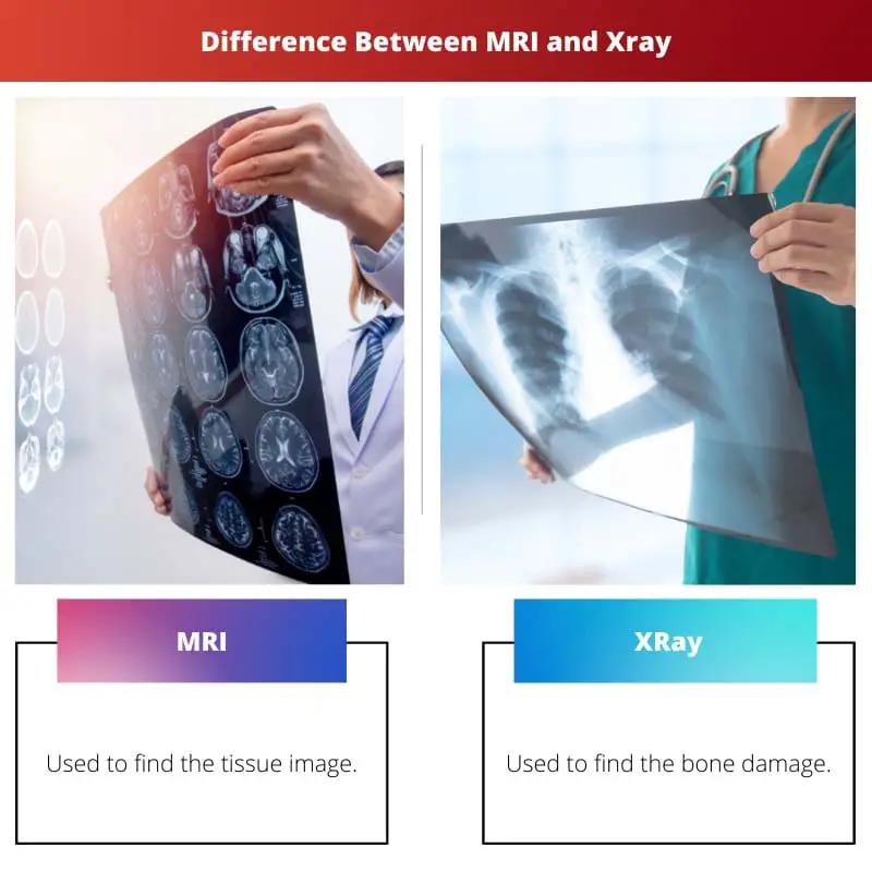 Difference Between MRI and Xray