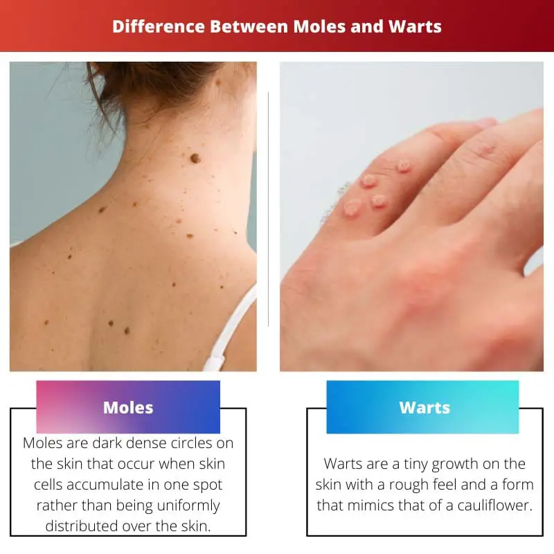 Difference Between Moles and Warts