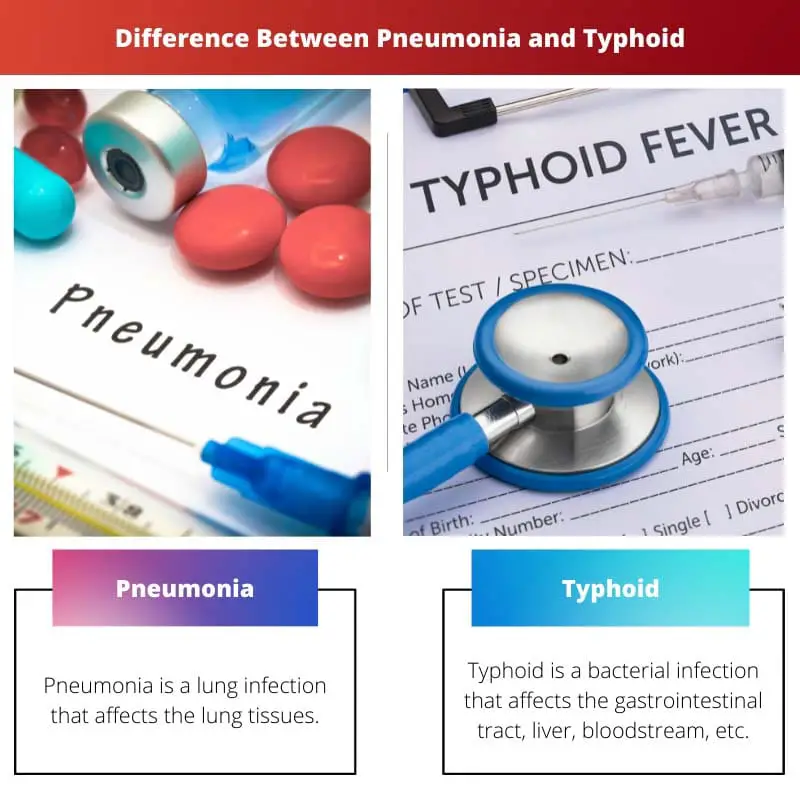 Difference Between Pneumonia and Typhoid