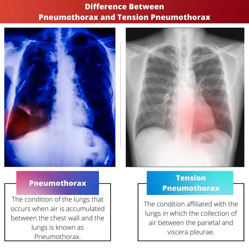 Difference Between Pneumothorax and Tension