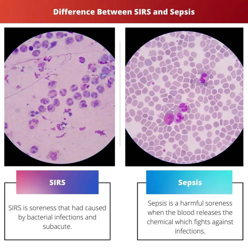 Difference Between SIRS and Sepsis