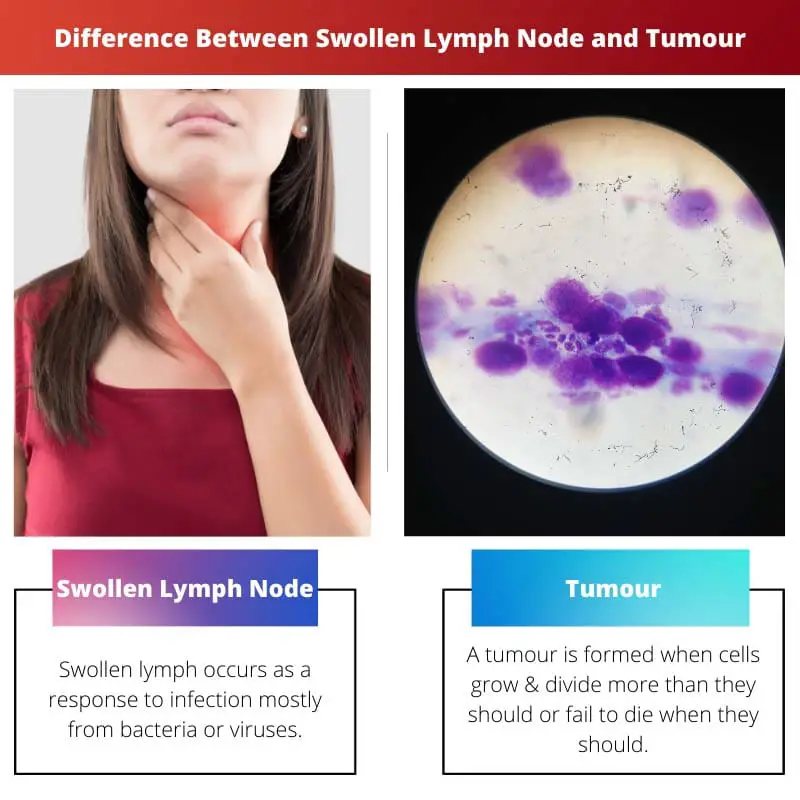 Difference Between Swollen Lymph Node and Tumour