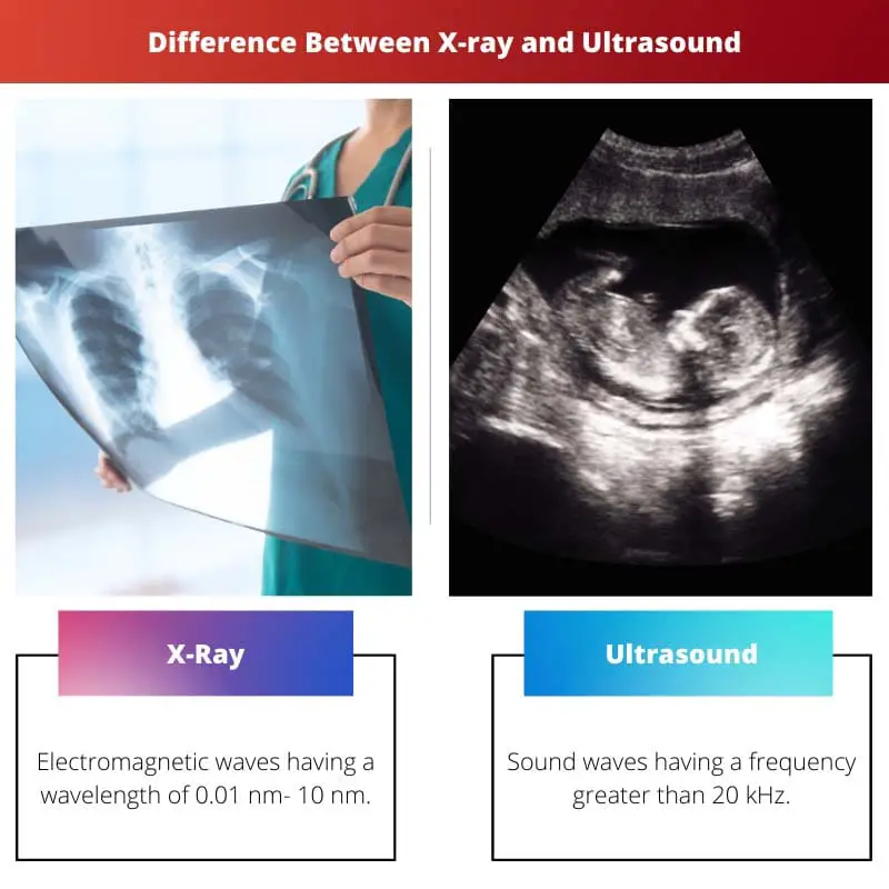 Difference Between X ray and Ultrasound
