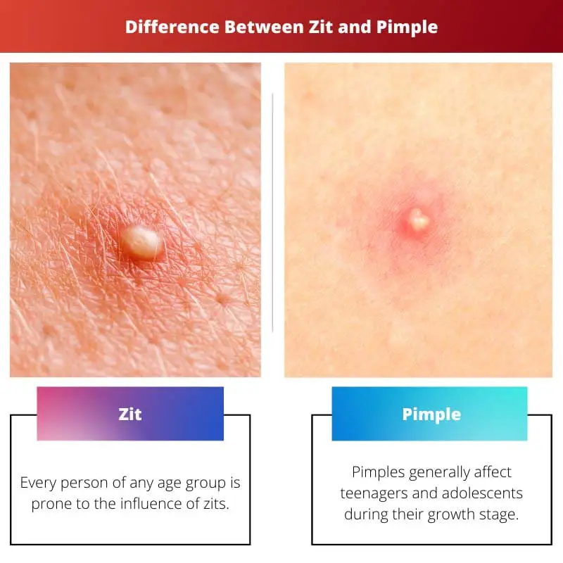 Difference Between Zit and Pimple