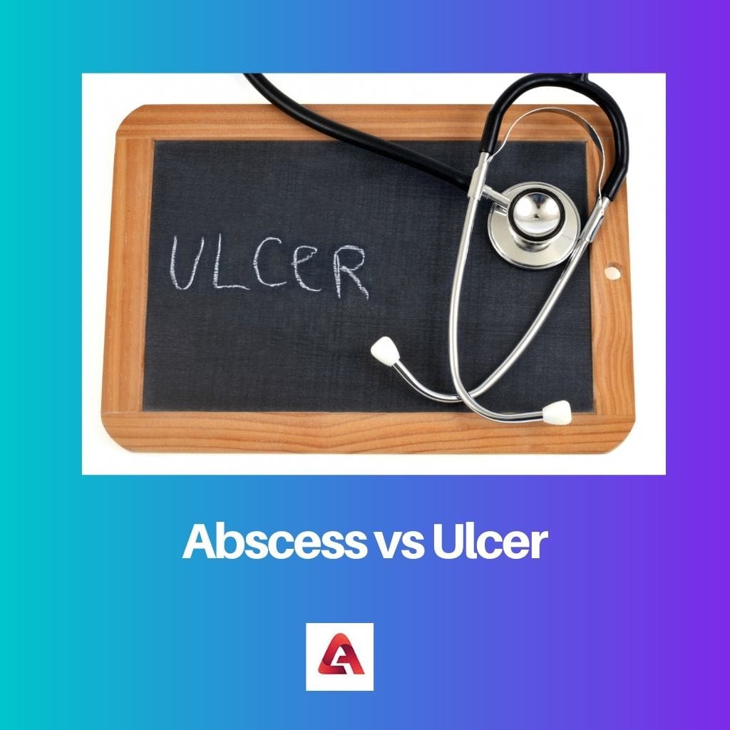 Abscess vs Ulcer