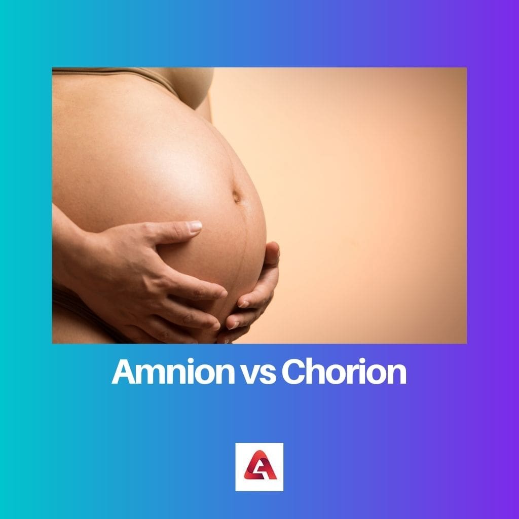 Amnion vs Chorion