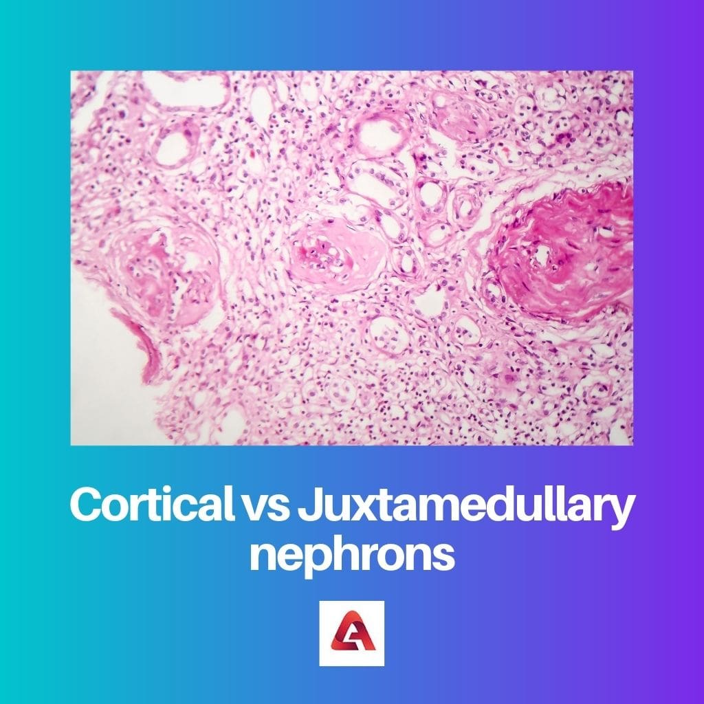 Cortical vs Juxtamedullary nephrons