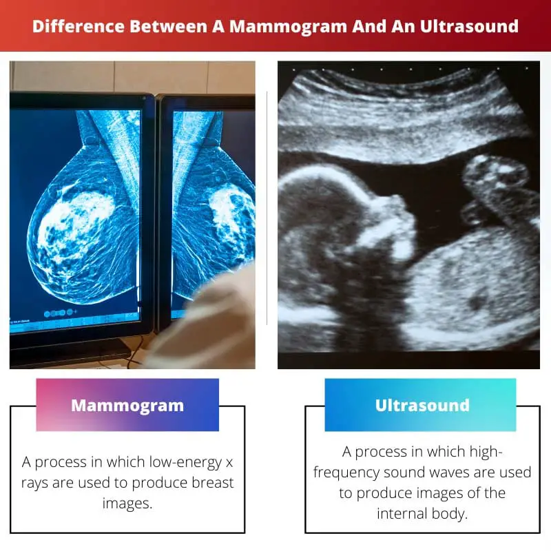 Difference Between A Mammogram And An Ultrasound