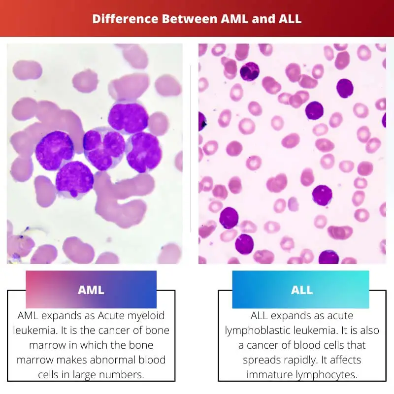 Difference Between AML and ALL