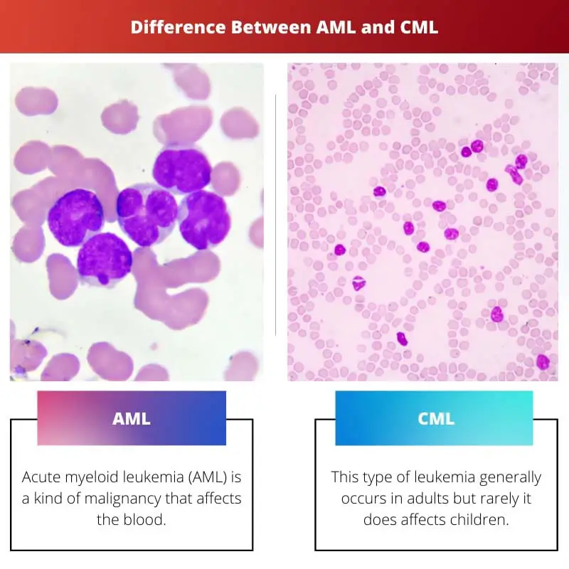 Difference Between AML and CML