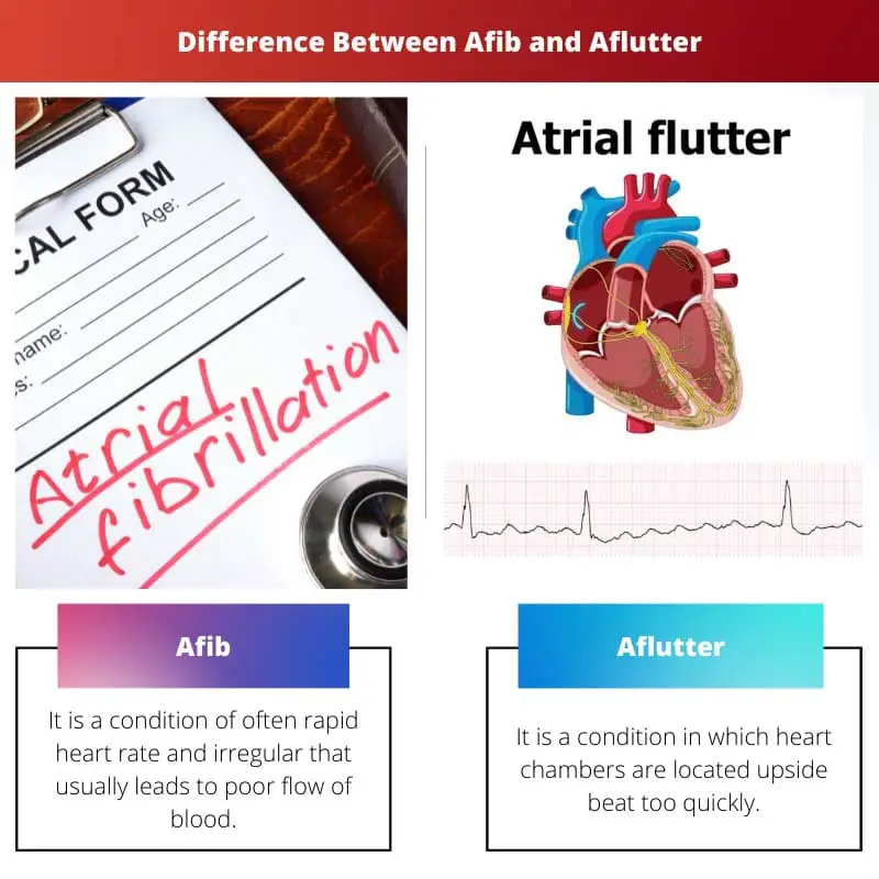 Difference Between Afib and Aflutter