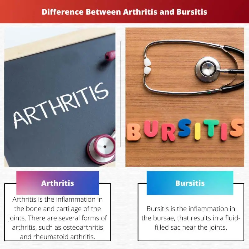 Difference Between Arthritis and Bursitis