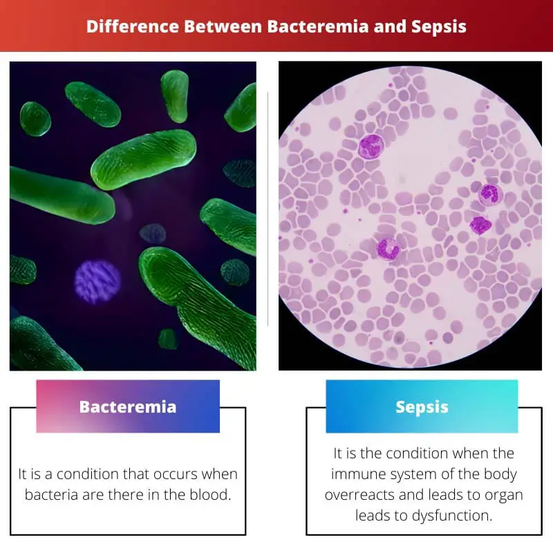 Difference Between Bacteremia and Sepsis