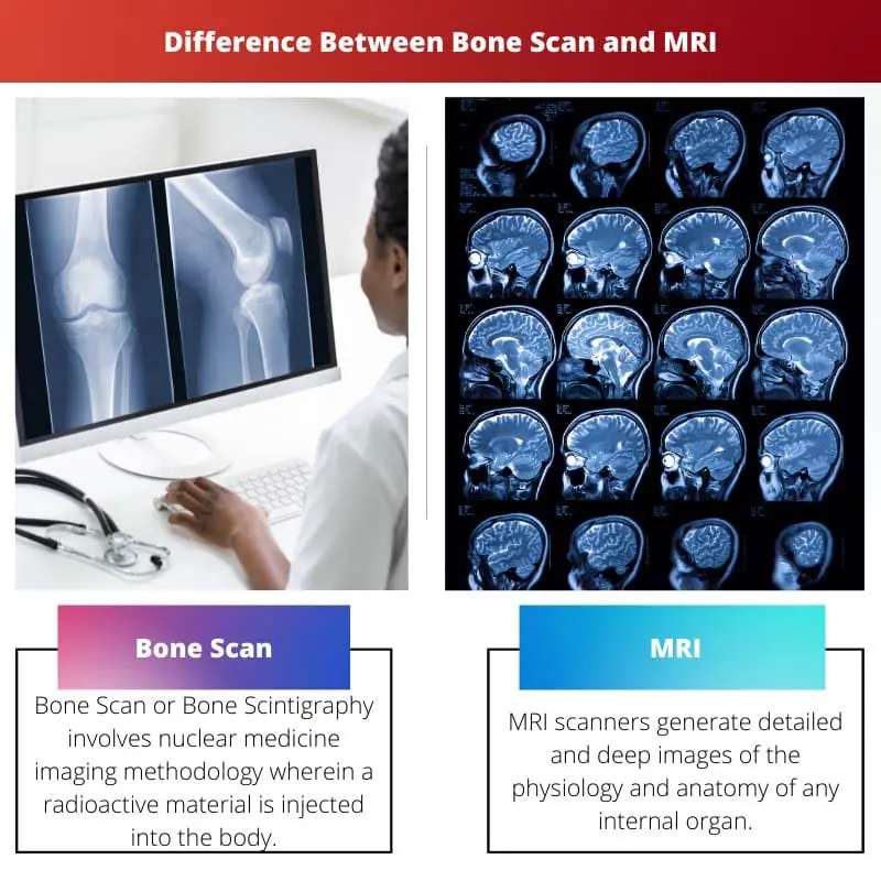 Difference Between Bone Scan and MRI