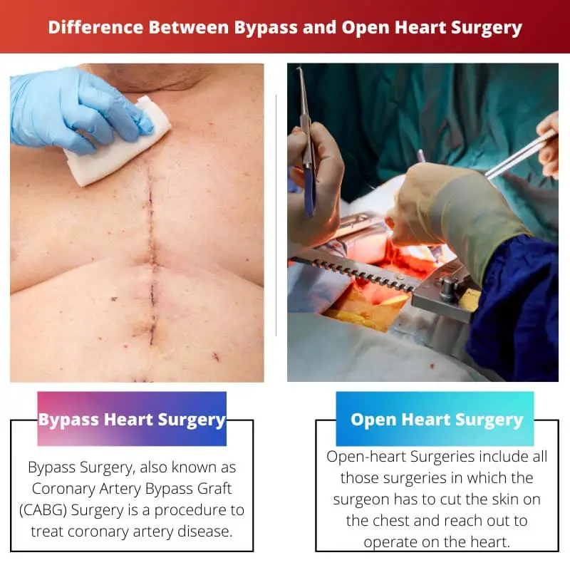 Difference Between Bypass and Open Heart Surgery