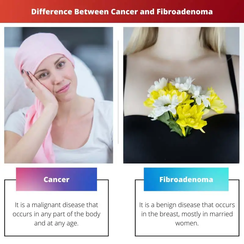 Difference Between Cancer and Fibroadenoma