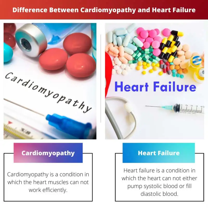 Difference Between Cardiomyopathy and Heart Failure