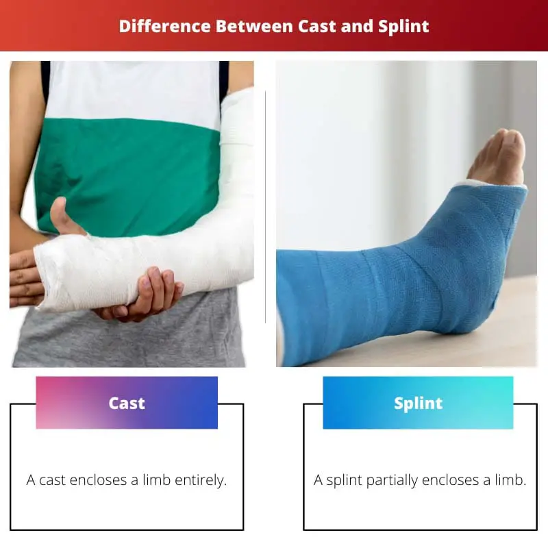 Difference Between Cast and Splint