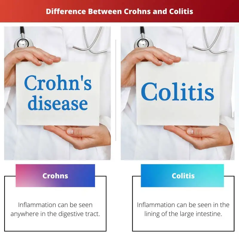 Difference Between Crohns and Colitis