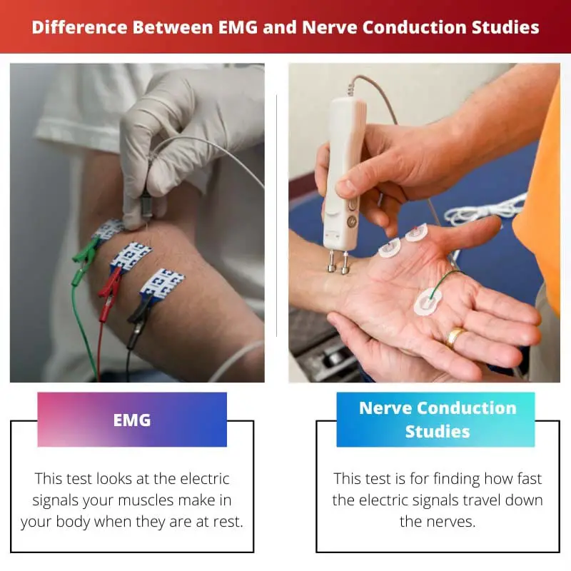 Difference Between EMG and Nerve Conduction Studies