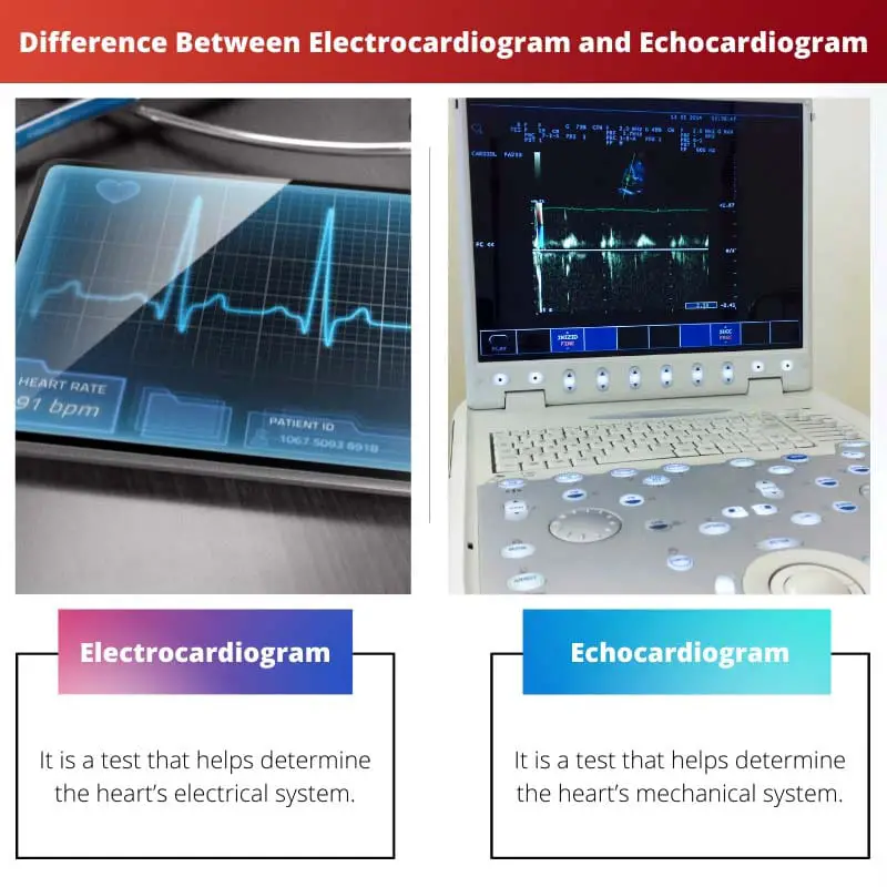 Difference Between Electrocardiogram and Echocardiogram
