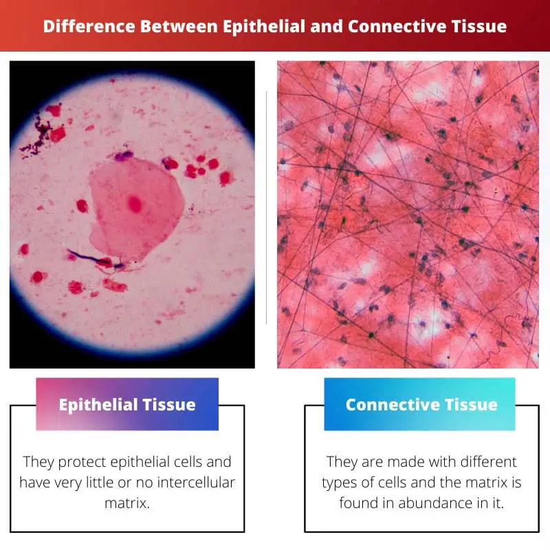 Difference Between Epithelial and Connective Tissue