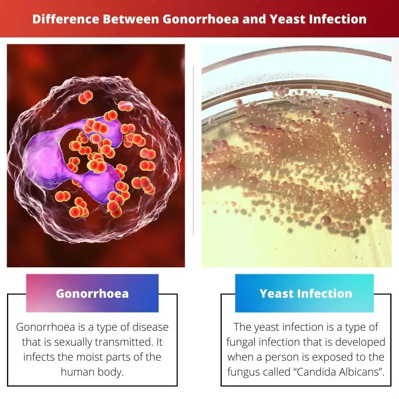 Difference Between Gonorrhoea and Yeast Infection