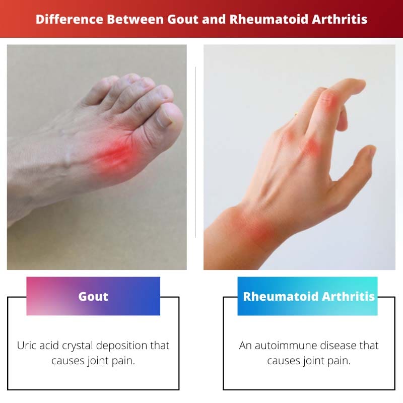 Difference Between Gout and Rheumatoid Arthritis