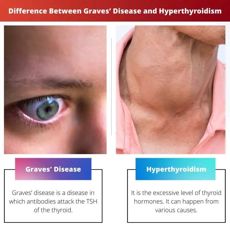 Difference Between Graves Disease and Hyperthyroidism