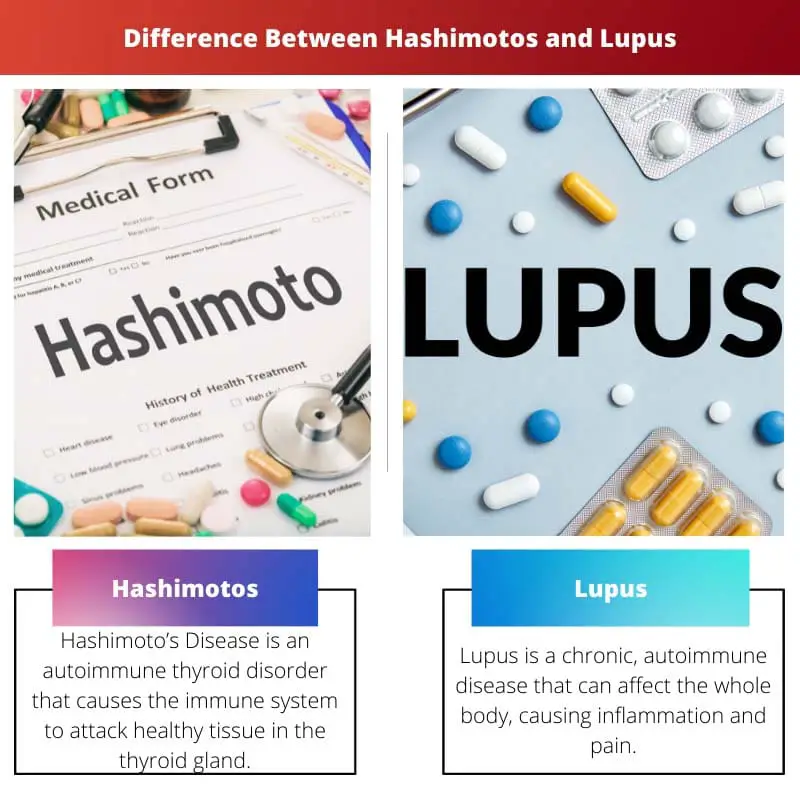 Difference Between Hashimotos and Lupus