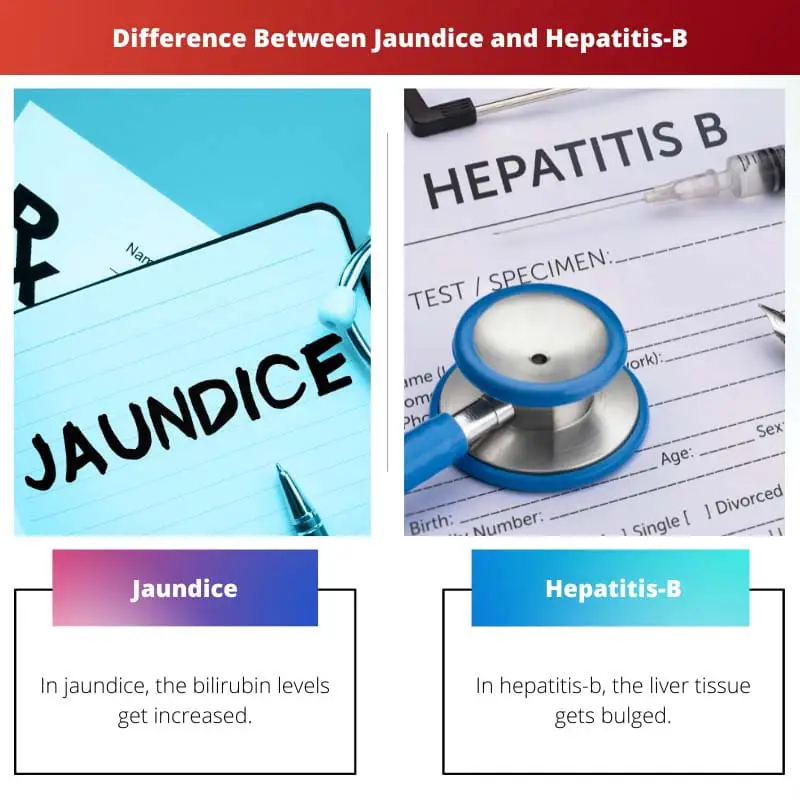 Difference Between Jaundice and Hepatitis B