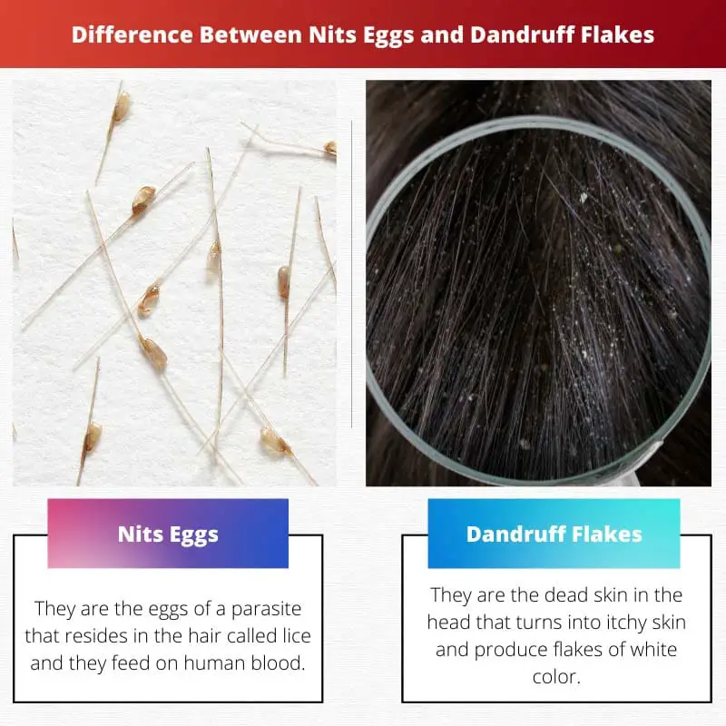 Difference Between Nits Eggs and Dandruff Flakes