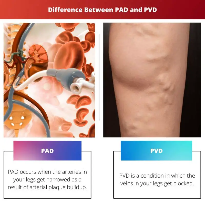 Difference Between PAD and PVD